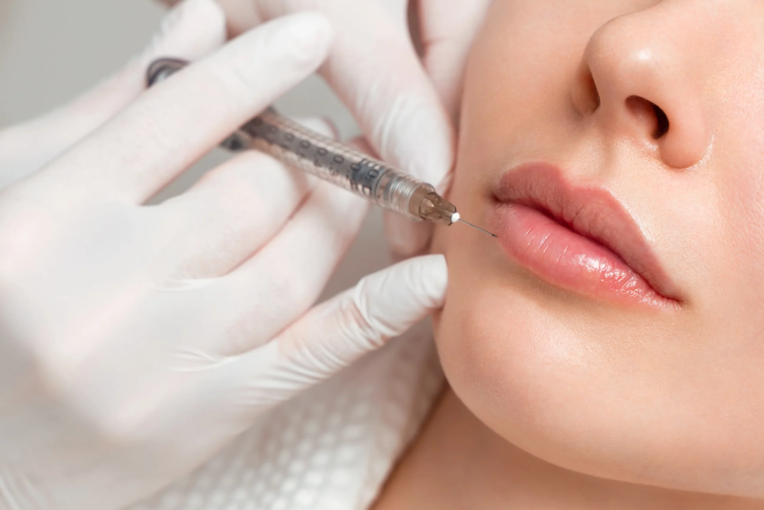 Dermal Fillers Treatment in Reno, NV