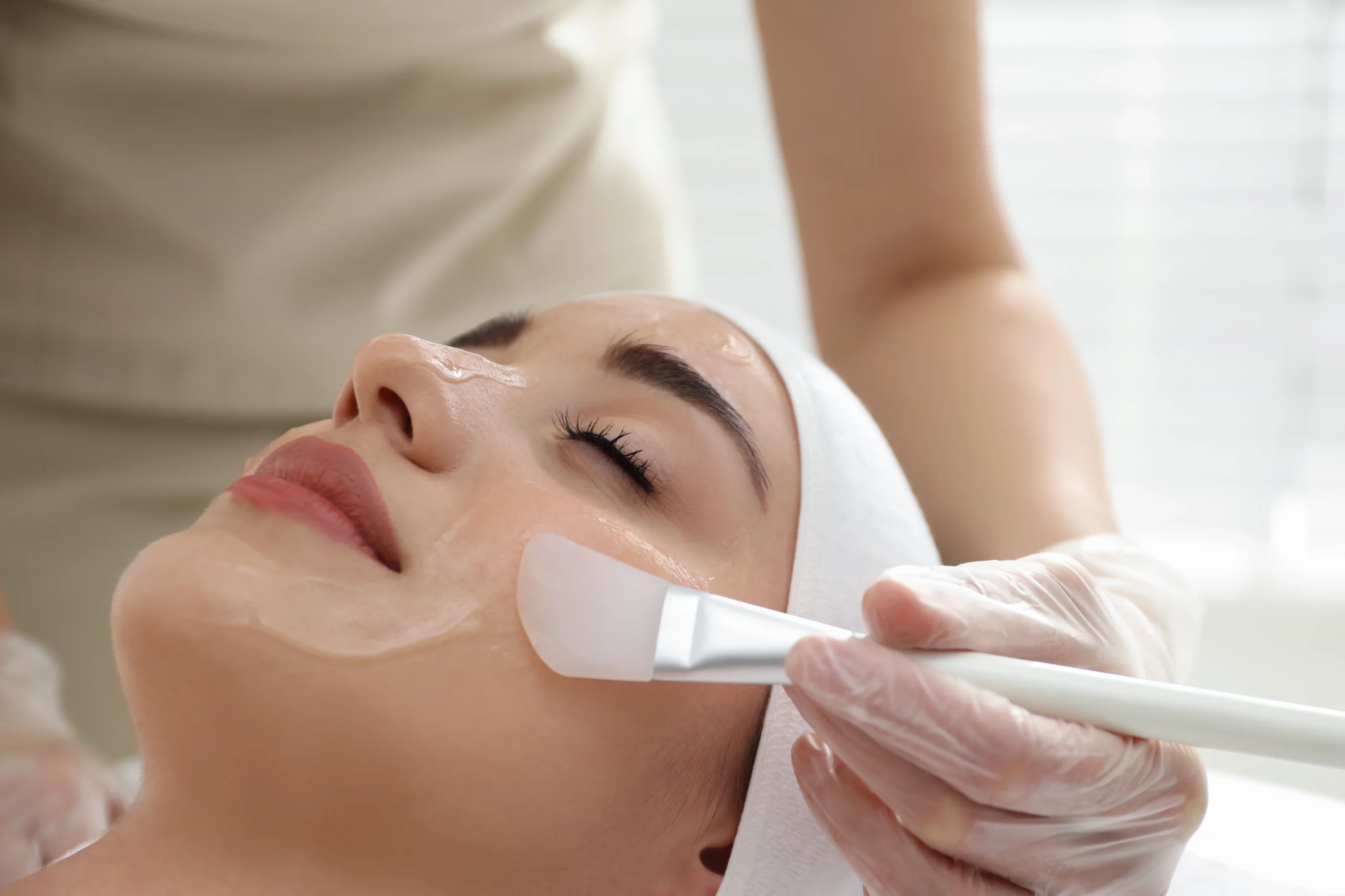 Chemical Peels in Reno, NV